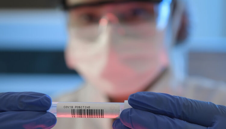 Última etapa do maior estudo epidemiológico sobre a Covid-19 é realizada no Brasil